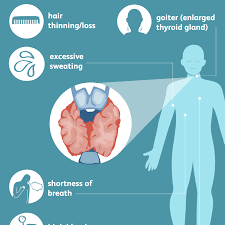 hyperthyroidism signs symptoms and complications