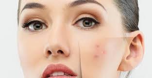 ØµÙØ±Ø© Ø°Ø§Øª ØµÙØ©