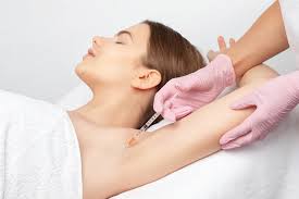HYPERHIDROSIS (EXCESSIVE SWEATING ...