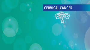 Cervical cancer refers to cancer that originates in the cervix of the uterus. Treatment Of Stage Iv Cervical Cancer Cancerconnect