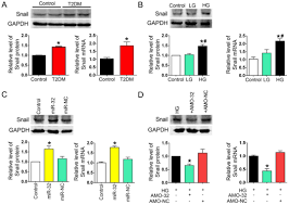 Buna ziua, intrebare si anume : High Glucose Promotes Hepatic Fibrosis Via Mir 32 Mta3 Mediated Epithelial To Mesenchymal Transition