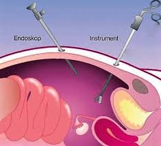 Es gibt viele vorteile, aber auch substanzielle nachteile eine sterilisation bzw kastration des hundes sollte man aber nur vornehmen, wenn wirklich wichtige. Endoskopische Kastration Tierarztpraxis Am Rahmer Bach