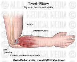 The anterior and the posterior compartments of the arm. Alila Medical Media Bones Joints And Muscles Images