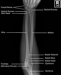 Forearm Radiographic Anatomy Wikiradiography Radiology Student Diagnostic Imaging Radiology