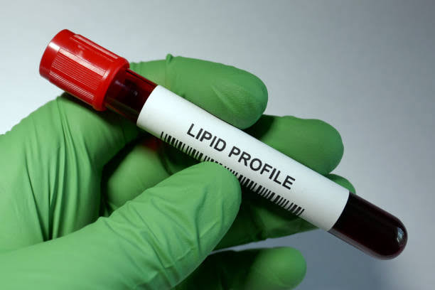 LIPID PRO product image
