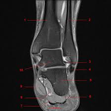 L'articulation de la cheville est formée par trois os : Anatomie Irm De La Cheville