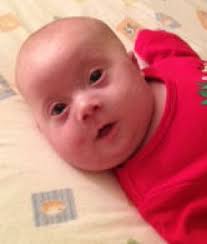 Miles Brewer Obituary