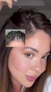 Cuida tu cuero cabelludo y tu pelo con #REJUVENIQE 💜 Isabel tenía el ...