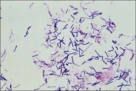 Image result for Clostridium