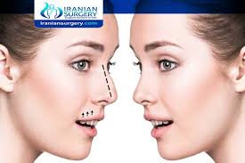 Check spelling or type a new query. Rhinoplasty Age Limit At What Age Can You Get A Nose Job Rhinoplasty Age