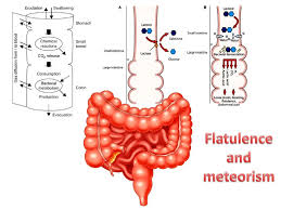Image result for Flatulence
