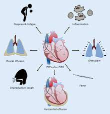 Often the only sign of myocarditis is rapid heartbeat, which is out of proportion to the severity of the infection. Postcardiac Injury Syndrome After Cardiac Implantable Electronic Device Implantation Springerlink
