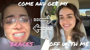FINALLY getting my braces off...