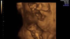 Tipps und hinweise für die 13. Gesundheit Der Frau Ultraschall 3d 4d Doppler
