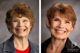 Hamblin Dental Implant and Aesthetic, 10011 S Centennial Pkwy, Ste 540,  Sandy, UT 84070, US