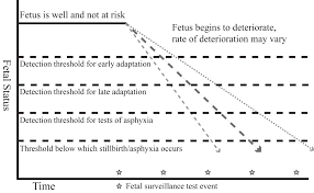 Image result for Fetal Testing Indications