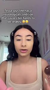 Tessa in A Wheelchair