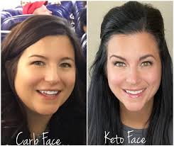 What changes have you experienced with PCOS since starting this way of  eating?