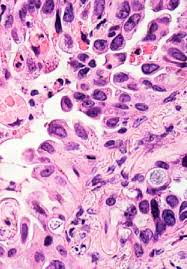 Besides chromomycin a2, chromomycin a3 and demethylchromomycin a2 were also identified from the extract derived from streptomyces sp., recovered from paracuru beach, located in the northeast region of brazil. Apoptosis And Activation Induced Cell Death Intechopen