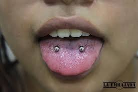 Oberflachen Zungenpiercing Piercing Oberflachenpiercing Zungenpiercing Zungenpiercing Piercingbarcelona Barcelona Zungenpiercing Piercing Zungenpiercings