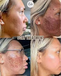 Embracing your unique beauty and imperfections