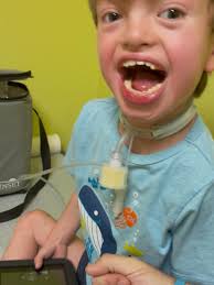 Landon Hall Tatum: CDH + CHD Journey