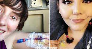 Discover if a chemotherapy port is a better choice than an iv. What To Know About Picc Lines And Ports Cancer 101