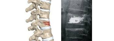 Image result for Kyphocarpa cruciata