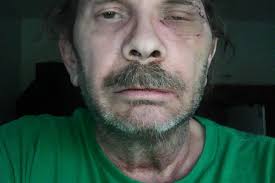 Fundraiser by George Wilkinson : Bill Needs A Little Help