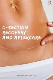 C Section Recovery Caesarean Aftercare Cesarean Recovery C Section Recovery C Section