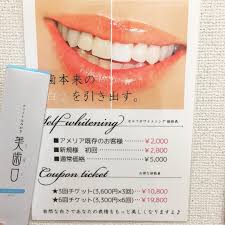 ホワイトニング 歯石除去 歯石