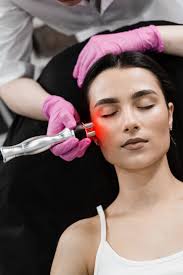 RF Skin Tightening