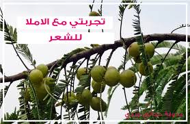 حياتي وردي تجربتي مع الاملا للشعر بكل بساطة