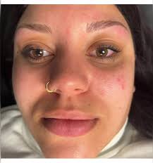 A beautiful difference 🫶🏼