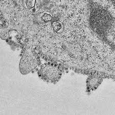 Coronavirus The First Three Months As It Happened