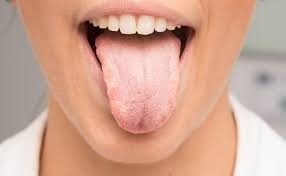 What Causes Dry Mouth & How To Relieve It | Smartmouth