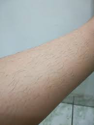Maybe you would like to learn more about one of these? I M A 12 Year Old Girl I Have Pretty Hairy Legs And I Hate Them I Ve Asked My Mom If I Can Shave But She Wouldn T Let Me I Ve Been Thinking Of