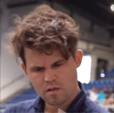 Most of the times patient presents with the complain of pain or discomfort  after Root Canal Treatment (RCT). There are multiple reasons for it but one  big reason