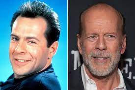 Start date jun 4, 2012; Bruce Willis Famous Bald Celebrities When They Had Hair Zimbio