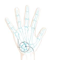 Image result for Hamate Bone