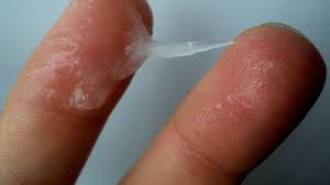 Brown smelly discharge before period. White Discharge Before Period Sign Of Pregnancy White Choices
