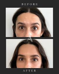 ATELIER AESTHETICS MIAMI (@atelieraestheticsmiami) · Miami, FL