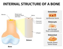 Breast cancer that has spread to the bones may cause: Understanding Metastatic Spine Cancer And Spinal Tumors