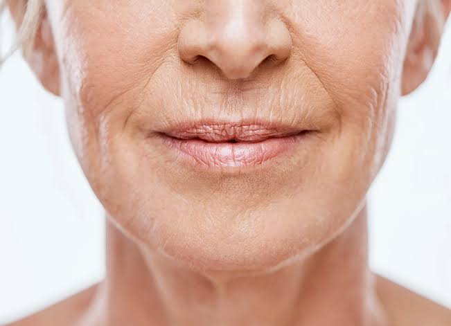 Fine lines & firmness