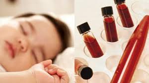 Cara menaikkan hb dengan cepat. Cegah Dan Atasi Anemia Pada Bayi Dengan Cara Ini Health Liputan6 Com