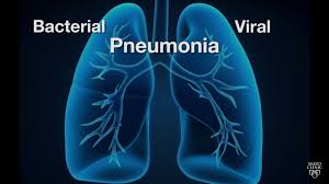 Video viral banglades viral di tiktok. Mayo Clinic Minute Is Pneumonia Bacterial Or Viral Youtube