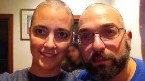 Another picture of hair loss after hysterectomy surgery: When A Hysterectomy Can Be A Death Sentence