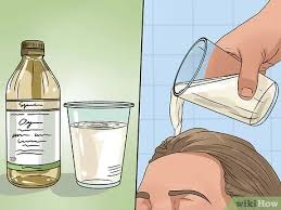 There are several treatments including home remedies for dandruff that can be used naturally in order to help get rid of dandruff fast, permanently … How To Remove Dandruff Using Vinegar 12 Steps With Pictures