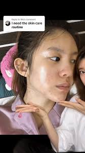 Cựu idol Kpop chia sẻ bí quyết trị mụn thâm, hé lộ một sự thật ít ai biết  về làn da "mộc" của các ngôi sao Hàn