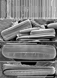 A blog dedicated to one of the most beautiful fashion model, ambassador of natural. Nagumoea Serrata Majewska Et Van De Vijver Sp Nov 1 23 Light Download Scientific Diagram